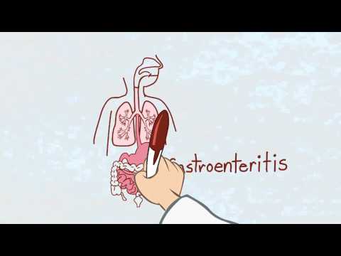 What is Stomach Flu? What is Stomach Flu?