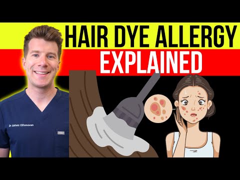 How long does an allergic reaction to hair dye last?