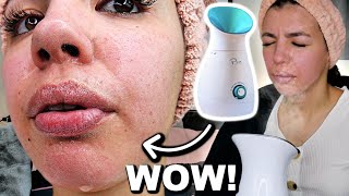 I Tested The Best FACIAL STEAMER On Amazon!