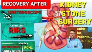 precautions, rest after kidney stone surgery किडनी स्टोन सर्जरी के बाद रिकवरी,परहेज kidney surgery
