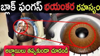 బయటకు వచ్చిన బ్లాక్ ఫంగస్ అసలు నిజం ఈలక్షణాలు కనిపిస్తే అస్సలు నిర్లక్ష్యం చేయకండి లేదంటే మీ ప్రాణాల