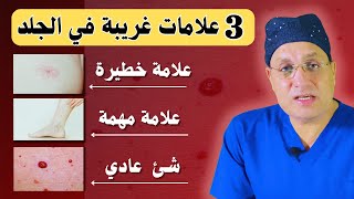 3 علامات غريبة في الجلد : مرض خطير و شئ عادي |معلومات صحية مفيدة