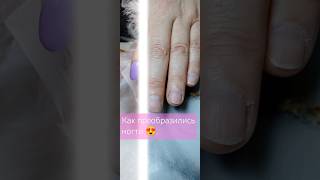 Преображение рук #преображение #nails #beauty #dipnails #manicure #dippowder #наращиваниеногтейпудра