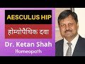 AESCULUS HIP | Homeopathic Medicine | Piles | Hindi | Dr. Ketan Shah |