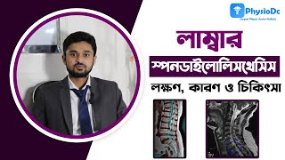 স্পন্ডালাইলোলিস্থেসিস/ Spondylolisthesis/ কোমড়ের হাড় সরে গেলে কি চিকিৎসা করবেন? জেনে নিন সঠিক সমাধান