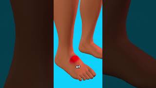 How To Treat A Scorpion Sting