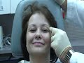 live botox procedure botox procedure with narrated step by step explanation of what is being done.