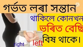 গৰ্ভত লৰা সন্তান থাকিলে কোনখন ভৰিত বেছি বিষ থাকে।@akhomiatgharuadihabychandr5480