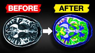 This Controversial Supplement Improves Brain Performance
