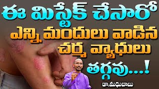 ఈ మిస్టేక్ చేసారో ఎన్ని మందులు వాడిన చర్మం వ్యాధులు తగ్గవు ...! | Dr. Madhu Babu | Health Trends|