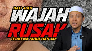 HATI-HATI WAJAH RUSAK TERKENA SIHIR DAN AIN!!