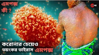 করোনার চেয়েও ভয়ংকার মহামারি এমপক্স | এমপক্স কী? Mpox Virus | ঘটনা