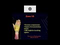 mri of the wrist part 8 wrist tendons