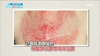 [Happyday]If you have a red face, menopause?! 얼굴이 붉어진다면 갱년기?! [기분 좋은 날] 20171121