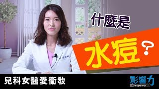 兒科女醫愛衛教05：孩子變成小花貓？什麼是水痘