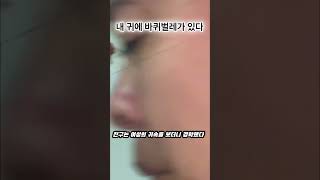 이 여성의 귀속에는 바퀴벌레가 살고 있습니다.