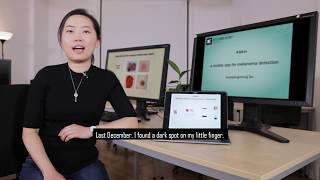 Diagnosing Skin Cancer Using Machine Learning