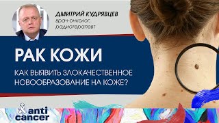 Рак кожи: как распознать опасное новообразование?