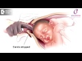 Methods of Labour Induction - Dr. Padmini Isaac | Cloudnine Hospitals Methods of Labour Induction - Dr. Padmini Isaac | Cloudnine Hospitals