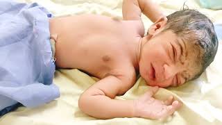 Newborn baby girl trying to open eyes first time | 2.3 kg weight | 35 weeks gestation @BabyWorld22