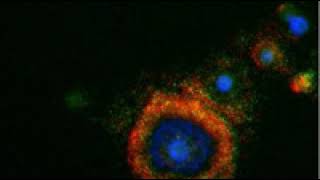 Biomarker (cell) | Wikipedia audio article