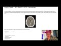 hy usmle q 375 – neurology