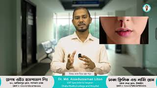 নাক দিয়ে রক্ত পড়ার ঘরোয়া চিকিৎসা।   Epistaxis । Dr Assaduzzaman Liton