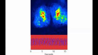 Interneuron activity in the olfactory bulb