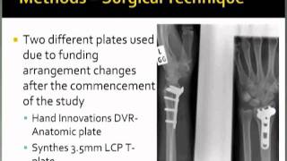 Unstable Extra-articular Distal Radial Fractures - Kwire vs Plating - by Dr Martin Blum