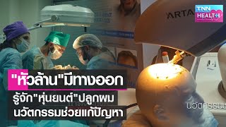 “หัวล้าน” มีทางออก รู้จัก“หุ่นยนต์ปลูกผม”นวัตกรรมช่วยแก้ปัญหา l TNN HEALTH l 02 04 65