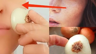 How to Get Rid of Pigmentation, Dark Spots Easily At Home