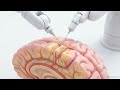 Brain Computer Interfaces — How Neuralink Works