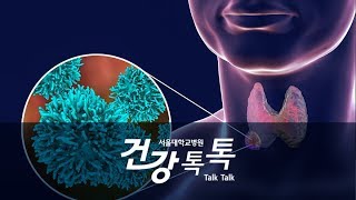 이규언 교수's Health Talk - 갑상선암의 원인과 증상