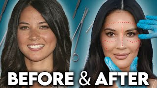 Olivia Munn Before After 2025 Shocking Plastic Surgery Transformation Explained