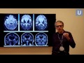 Best Practices & Emerging Therapies for Patients with Alzheimer’s Disease | UCLAMDChat