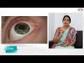 part 4 things to taken care after lasik dr. kala baby thottam ahalia eye hospital ernakulam