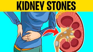 8 SUBTLE Signs of Kidney Stones You Shouldn’t Ignore