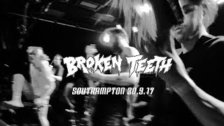 Broken Teeth - 30.9.17 - SOUTHAMPTON - FULL SET