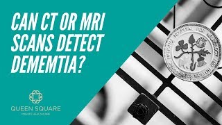 Can a CT or MRI scan detect dementia? - Dr Simon Farmer