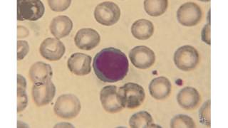 Blood 11. Blood cells, podcast