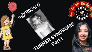 20.  TURNER SYNDROME-PART I