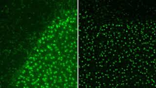 Huygens deconvolution