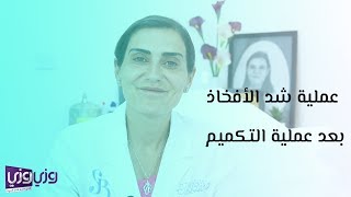 عملية شد الأفخاذ بعد عملية التكميم