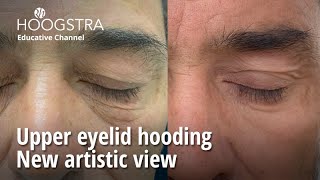 Upper eyelid hooding - New artistic view - 22238