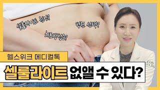 [헬스위크] 울퉁불퉁 셀룰라이트 없앨 수 있다? 원인부터 치료방법까지!