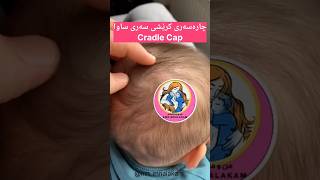 چارەسەری کرێشی سەری ساوا Cradle cap