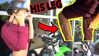 HE GOT OVER 40 STAPLES BECAUSE OF THIS ! | BRAAP VLOGS