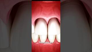 The Surgery To Reveal More Teeth 😨 Surgeon Reacts