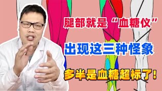 腿部就是“血糖仪”，出现这三种怪象，多半是血糖超标了!