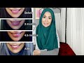 invisalign completed before and after amena